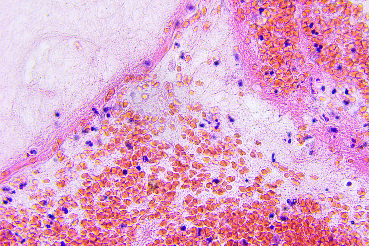 Microscopic photography of brain tissue.