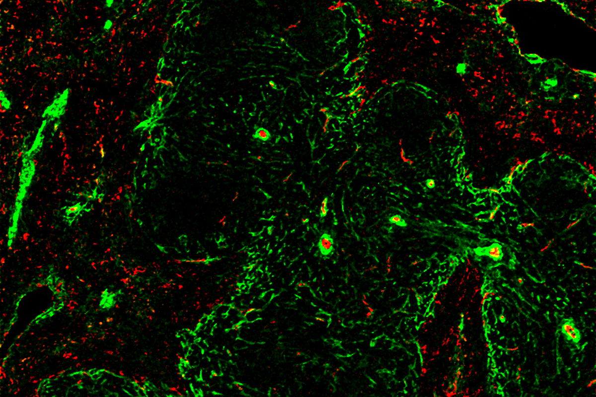 Mass Cytometry analysis of formaldeyde-fixed, paraffin-embedded (FFPE) tissues