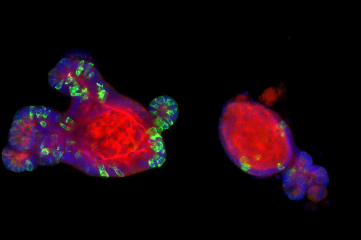 Two collections of bright red cells on a black background, the left is significantly larger than the right with a green perimeter.