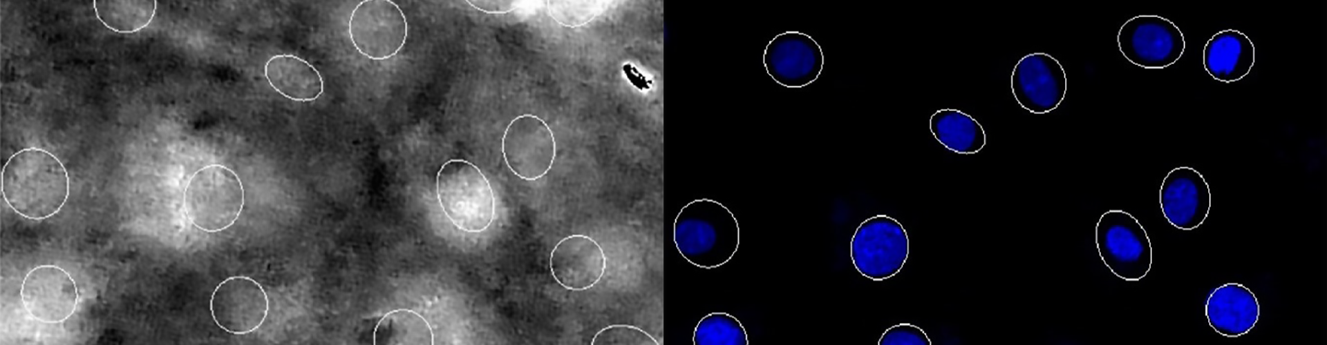 Small highlighted circles in grayscale indicate nuclei segmentation, next to bright blue circles in a similar location showing nuclei location after live-staining.
