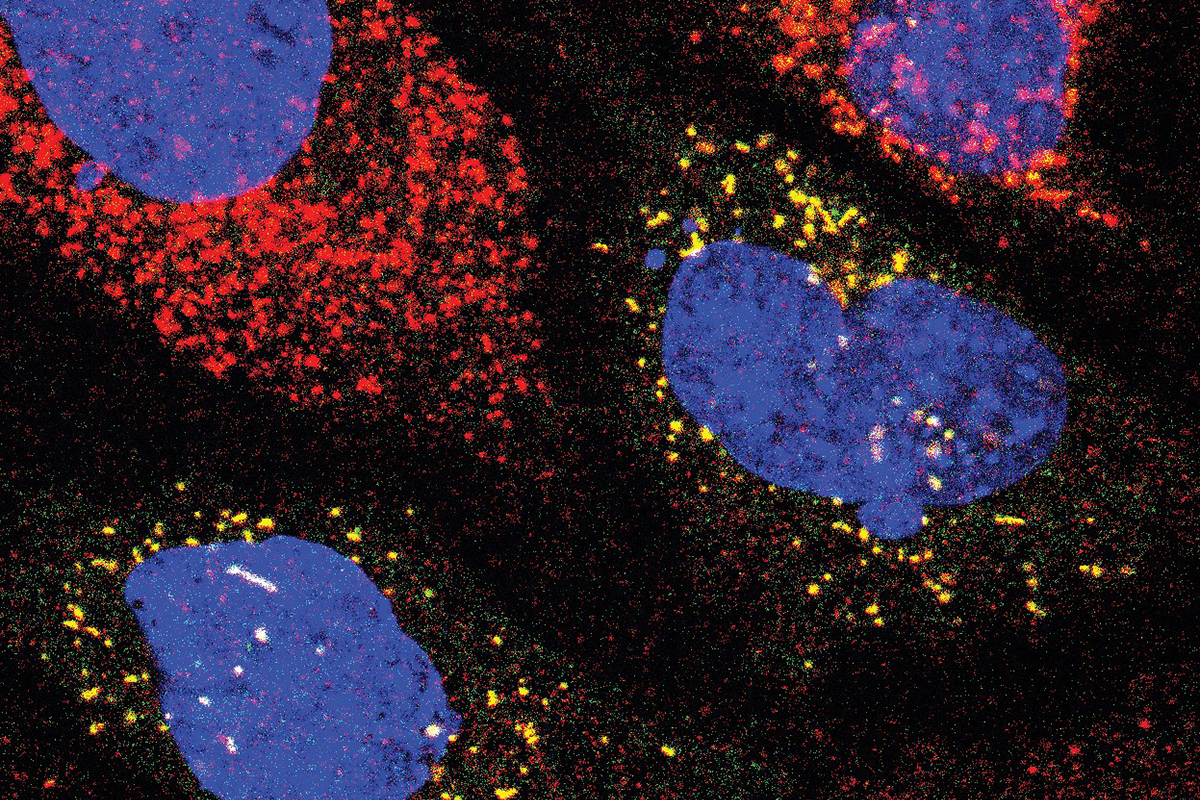 Blue oblong shapes against a black background with red and yellow dots surrounding the shapes showing disrupted cellular recycling.