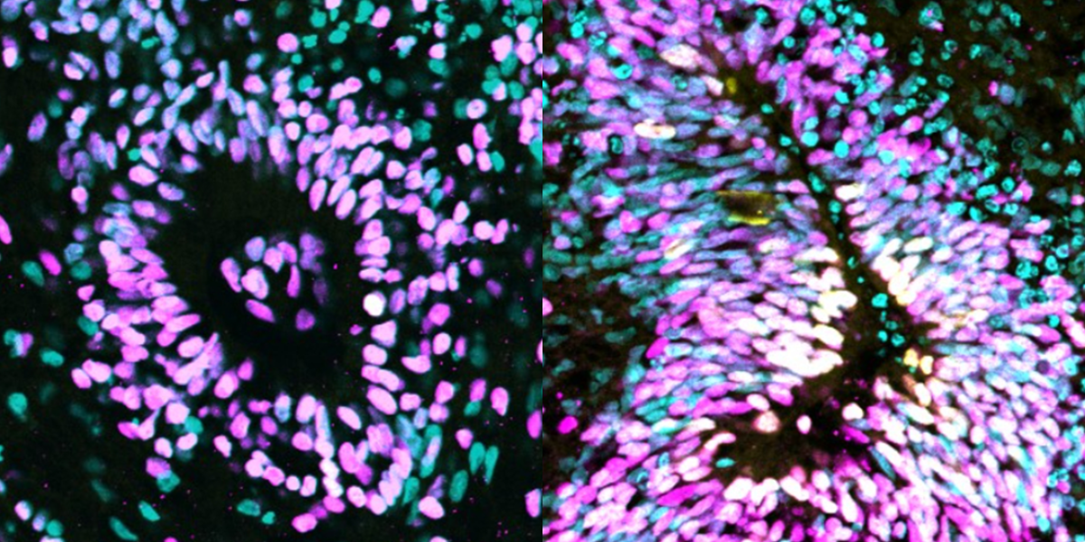 White, purple and turquoise flecks of colour against a black background.