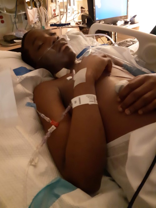 James lies in a hospital bed connected to tubes.